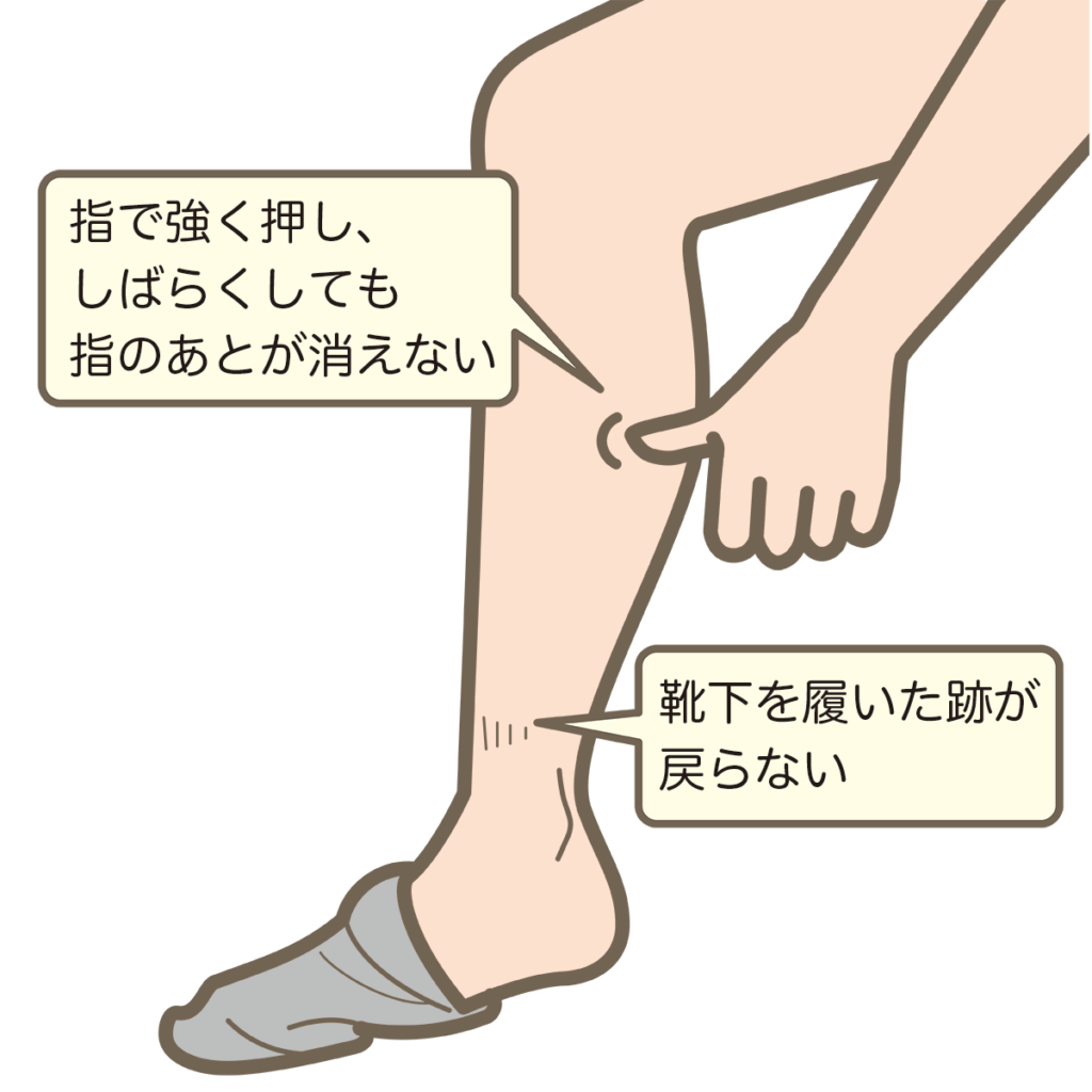 足のむくみとだるさの原因!?立ちっぱなしによる足の血管の病気と改善法 | Dr.ミニマリストの健康ライフ